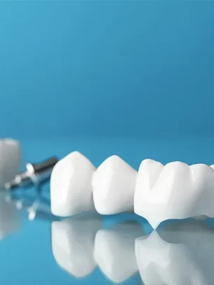 How Dental Crowns Reinforce and Restore Compromised Teeth in Poway