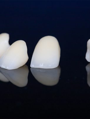 What Makes CEREC Same-Day Crowns Different? Benefits Explained